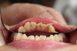 business-insurance-for-dentists-640x480-60214855.jpeg