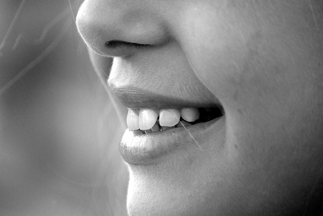 chin contouring with CoolSculpting