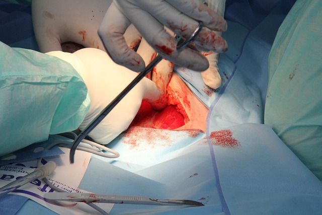 Cool Sculpting procedure