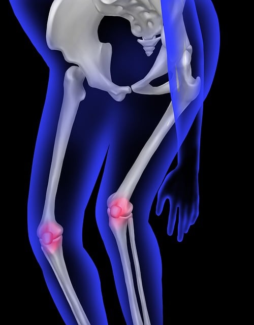CoolSculpting for legs