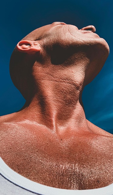 CoolSculpting jawline