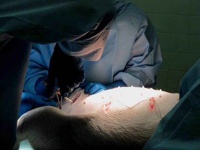CoolSculpting Procedure