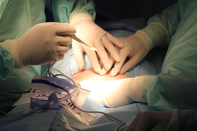 coolsculpting-procedure-640x480-96425299.jpeg