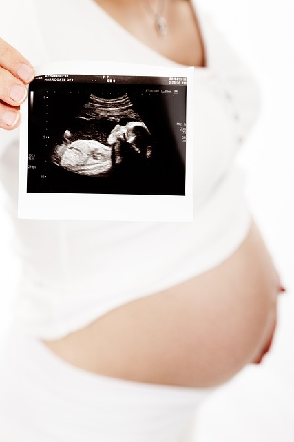 CoolSculpting tummy