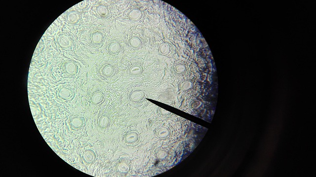 Fat Cell Freezing