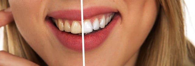 insurance for dental businesses