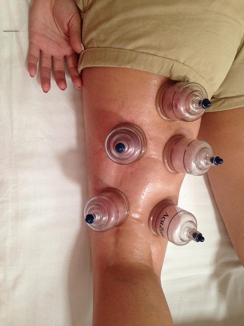 IVF acupuncture Austin