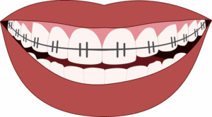 Streamline Your Dental Practice with Fast, Tailored Commercial Insurance