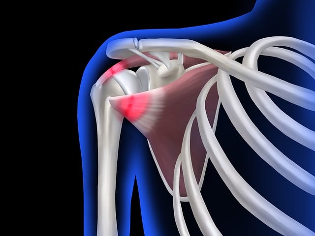 pain relief acupuncture