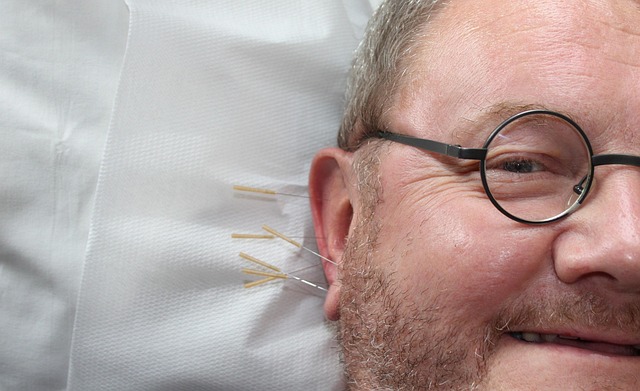 reproductive acupuncture