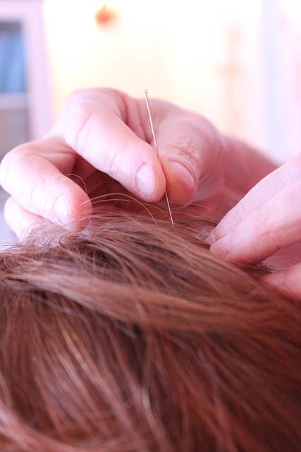 reproductive acupuncture