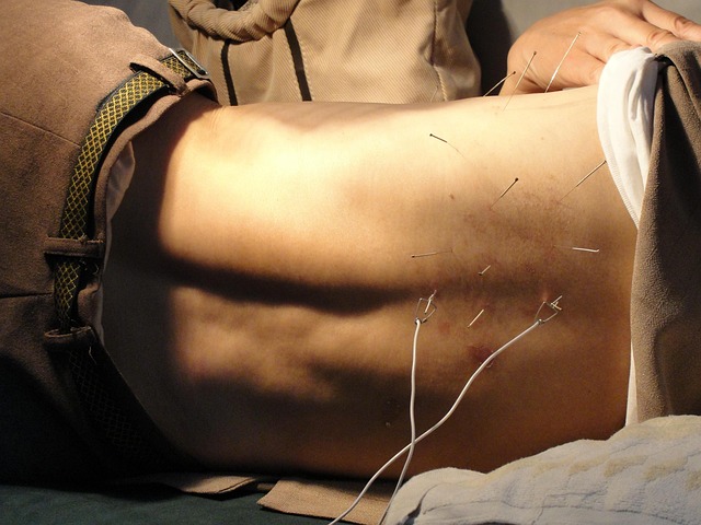 reproductive acupuncture