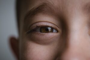 RF Skin Resurfacing: Revolutionize Wrinkle Reduction with Non-Invasive Technology