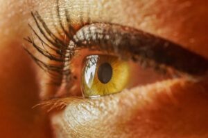 Morpheus8: Your Non-Invasive Skin Tightening Solution for Lasting Results