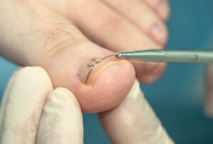 Custom Insurance for Specialty Healthcare: Tailoring Protection for Unique Practices