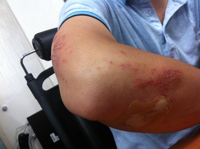 staff injury insurance medical