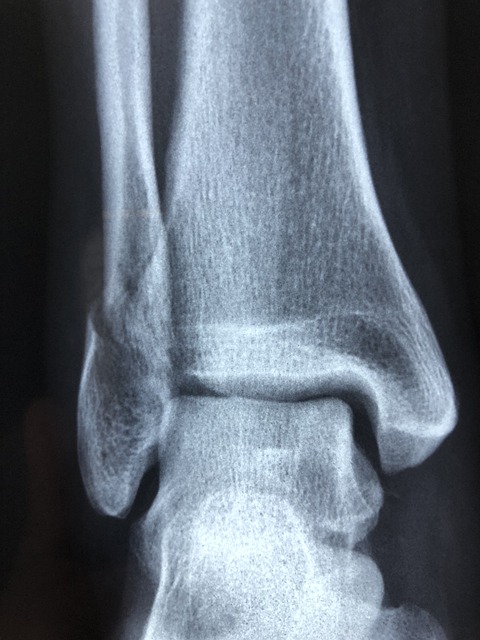 staff injury insurance medical
